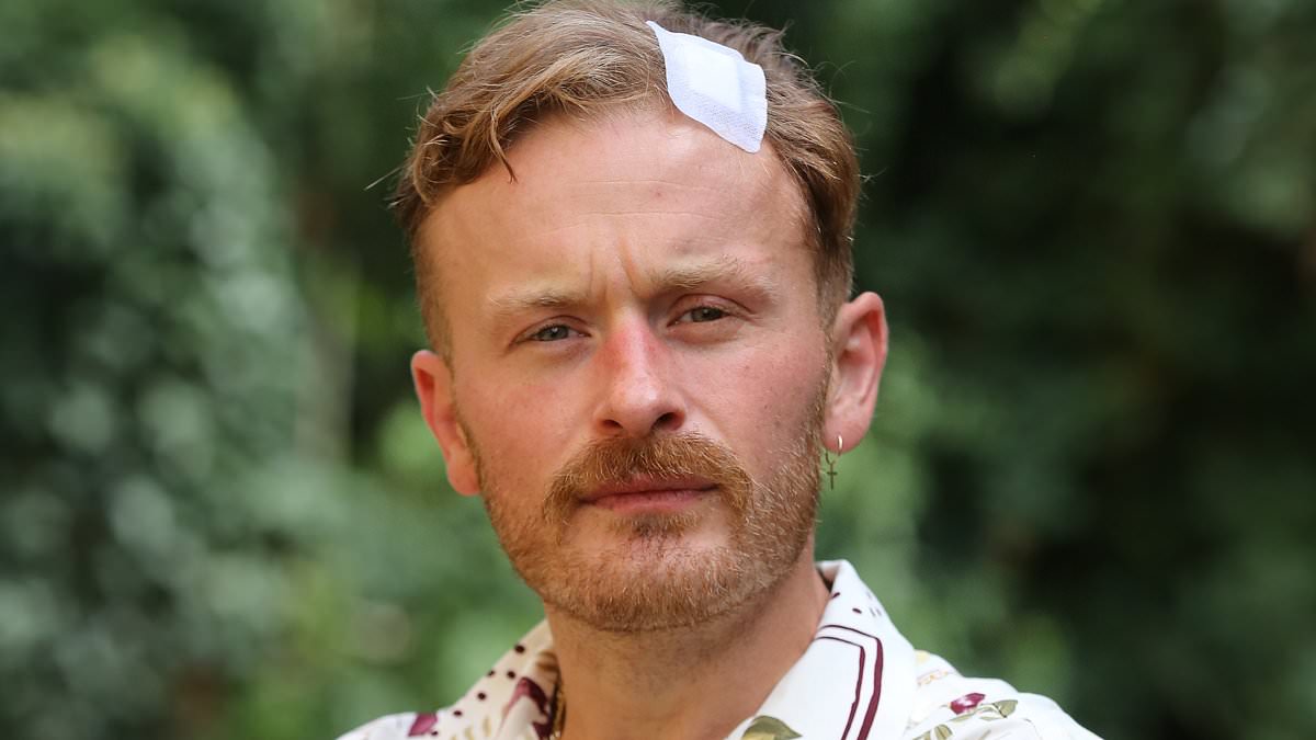 alert-–-man-who-says-he-was-struck-by-firebomb-after-he-put-up-st-george’s-flags-in-his-hometown-feared-it-was-an-acid-attack-and-he-was-going-to-die-or-be-blind-–-as-he-tells-mail-he-will-never-stop