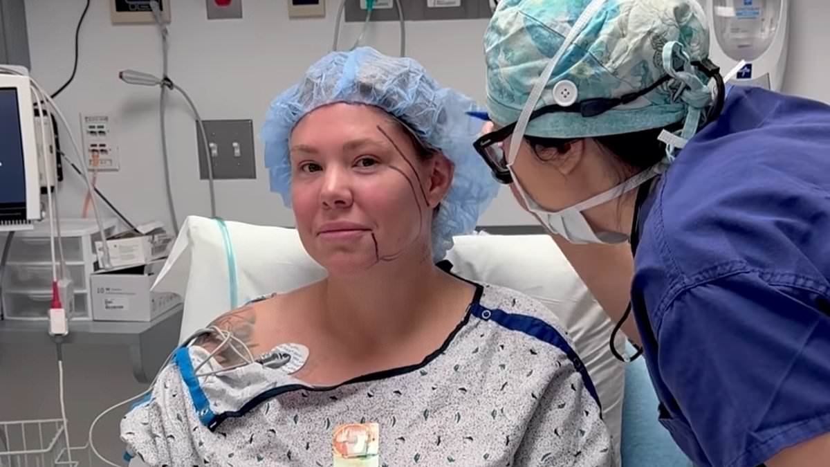 alert-–-teen-mom-star-kailyn-lowry-undergoes-surgery-to-get-‘snatched-jawline’-as-she-shares-dramatic-procedure-photos